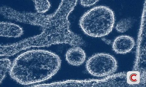 Nipah 2026: "Sát thủ" có tỷ lệ tử vong 40-75%, chưa có vaccine đặc hiệu