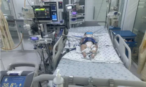 Bé gái hơn 1 tuổi nguy kịch vì phút lơ là của người lớn, bác sĩ cảnh báo thói quen "chết người"