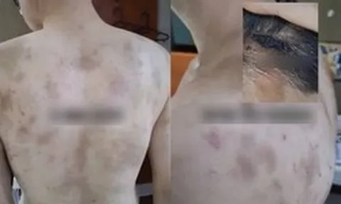 Rúng động Hàn Quốc: Nam nhân viên bị chủ quán hành hạ, ép làm việc 20 giờ/ngày, camera giám sát 24/7