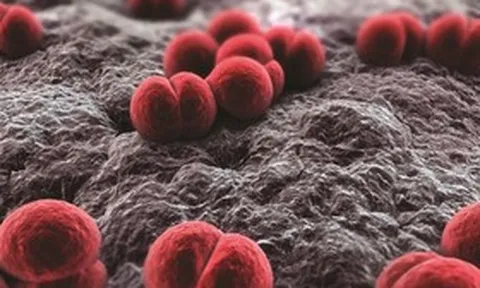 Viêm màng não mô cầu "sát thủ 24 giờ", bác sĩ cảnh báo nguy cơ