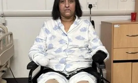 Bị chó cưng liếm, người phụ nữ "sốc" khi phải cắt cụt tay chân