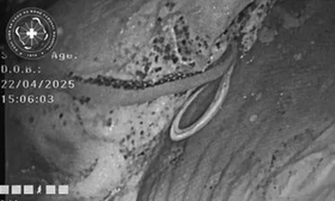 Đi siêu âm, người đàn ông chết lặng khi phát hiện sinh vật “đáng sợ” trong bụng