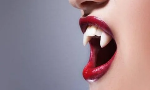 Mài răng nhọn như ma cà rồng, trào lưu gây sốc của giới trẻ khiến dân mạng rùng mình