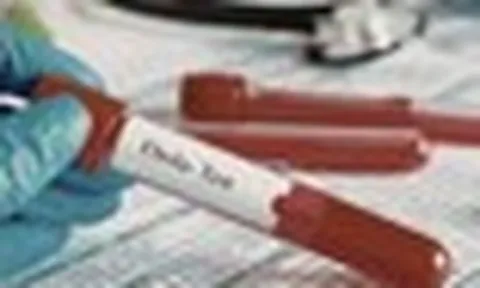 TPHCM tăng cường giám sát cửa khẩu, chủ động phòng nguy cơ dịch bệnh Ebola xâm nhập