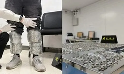 Phát hiện người đàn ông buộc 1.378 “vật lạ” quanh chân ở cửa hải quan