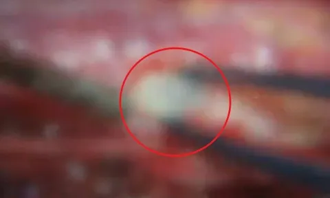Người phụ nữ đau lưng suốt 2 năm, bác sĩ phát hiện ra bí mật "đáng sợ"
