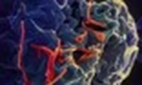Dịch Ebola diễn biến phức tạp, Bộ Y tế họp khẩn
