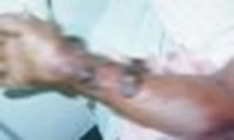 Vì sao WHO đánh giá nguy cơ Ebola vào Việt Nam ở mức thấp?