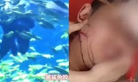 Du khách đi lặn bị cá mập cắn vào đầu, nhân viên vẫn hỏi “có muốn tiếp tục không?”