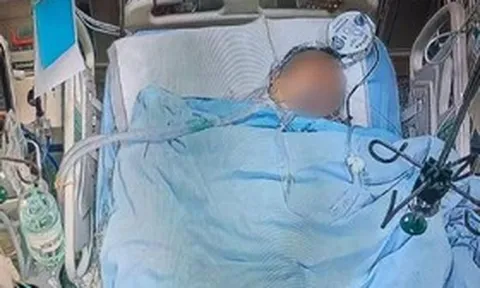 Đang cho gà ăn, người đàn ông bị con vật "đáng sợ" tấn công, diễn biến sau đó rùng mình